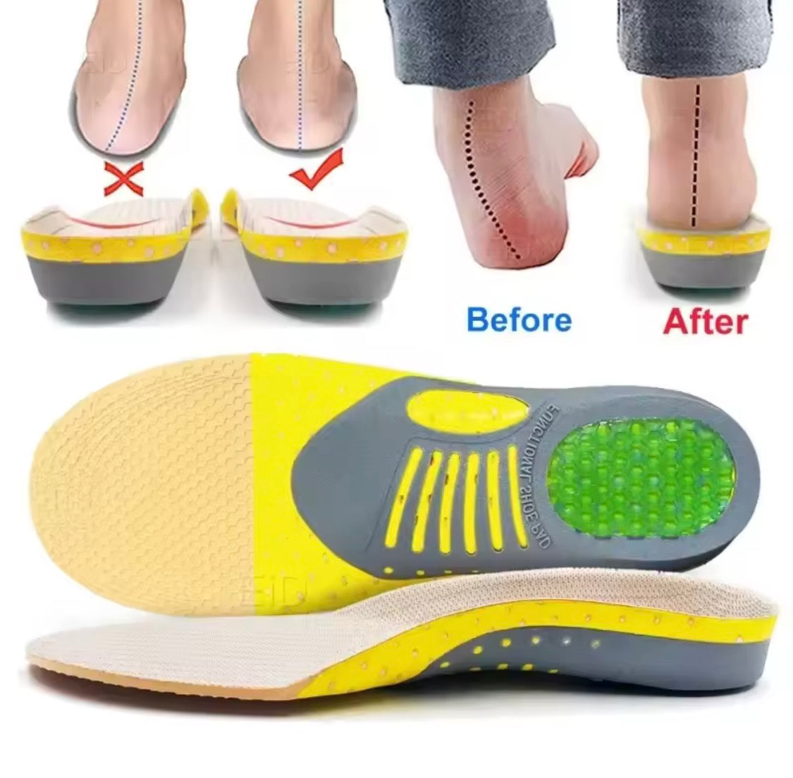 Solette Comfort Pro™ – Sollievo Immediato per Chi Cammina Tutto il Giorno